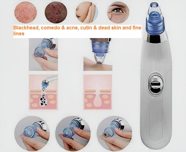 Derma Suction Acne Blackhead Remover Vacuum